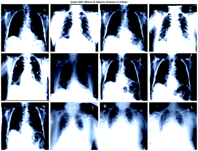 Multi-Disease Medical Diagnosis AI — AI project by Zain Abbas